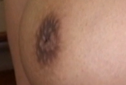 夏川未来の陥没乳首　拡大